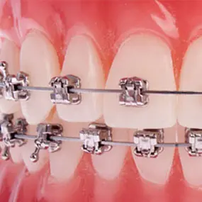 farmington orthodontist