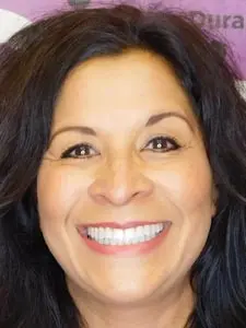 Four Corners Orthodontics & Dental - After treatment