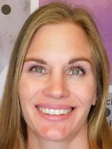 Four Corners Orthodontics & Dental - After treatment