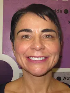 Four Corners Orthodontics & Dental - After treatment