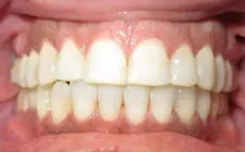 Four Corners Orthodontics & Dental - After treatment