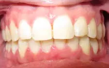 Four Corners Orthodontics & Dental - After treatment