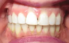 Four Corners Orthodontics & Dental - After treatment