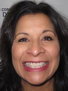 Four Corners Orthodontics & Dental - Before treatment