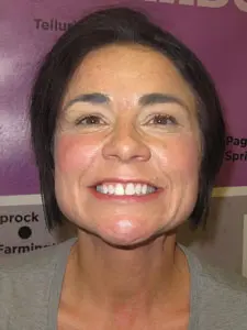 Four Corners Orthodontics & Dental - Before treatment