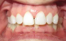 Four Corners Orthodontics & Dental - Before treatment