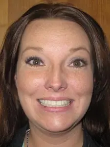 Four Corners Orthodontics & Dental - After treatment