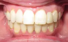 Four Corners Orthodontics & Dental - After treatment