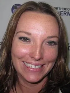 Four Corners Orthodontics & Dental - Before treatment