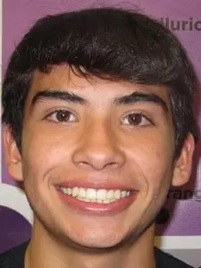 Four Corners Orthodontics & Dental - After treatment