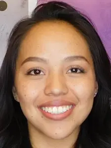 Four Corners Orthodontics & Dental - After treatment