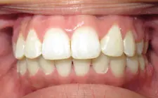 Four Corners Orthodontics & Dental - After treatment