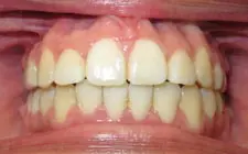 Four Corners Orthodontics & Dental - After treatment