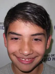 Four Corners Orthodontics & Dental - Before treatment