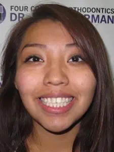 Four Corners Orthodontics & Dental - After treatment