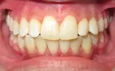 Four Corners Orthodontics & Dental - After treatment
