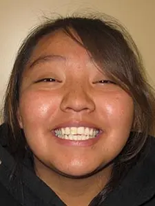 Four Corners Orthodontics & Dental - Before treatment