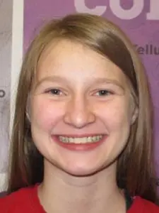 Four Corners Orthodontics & Dental - After treatment