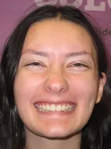 Four Corners Orthodontics & Dental - After treatment