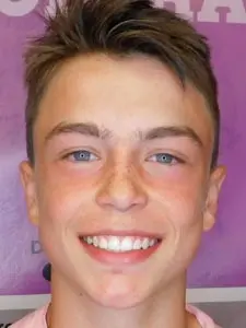 Four Corners Orthodontics & Dental - After treatment