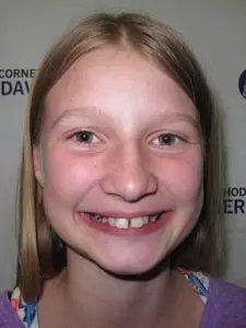 Four Corners Orthodontics & Dental - Before treatment