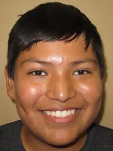 Four Corners Orthodontics & Dental - Before treatment