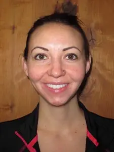 Four Corners Orthodontics & Dental - Before treatment