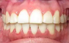 Four Corners Orthodontics & Dental - After treatment