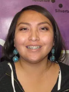 Four Corners Orthodontics & Dental - Before treatment