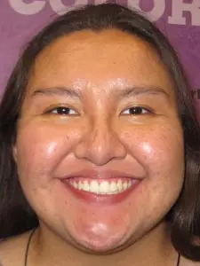 Four Corners Orthodontics & Dental - After treatment