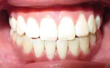 Four Corners Orthodontics & Dental - After treatment