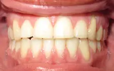 Four Corners Orthodontics & Dental - After treatment