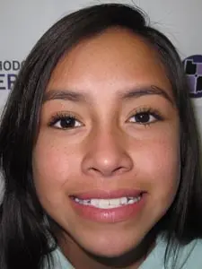 Four Corners Orthodontics & Dental - Before treatment