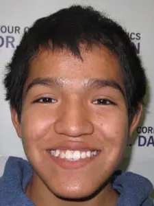 Four Corners Orthodontics & Dental - Before treatment