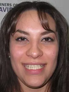 Four Corners Orthodontics & Dental - Before treatment