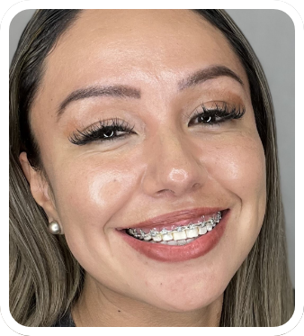 Braces at Four Corners Orthodontics