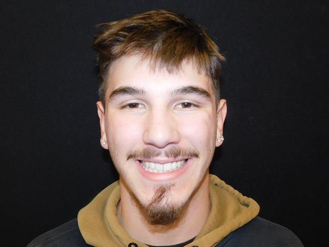 Tony - After Orthodontic Treatment