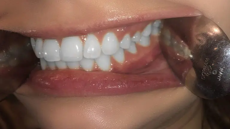 left smile