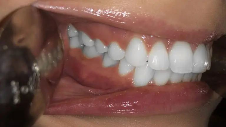 right smile