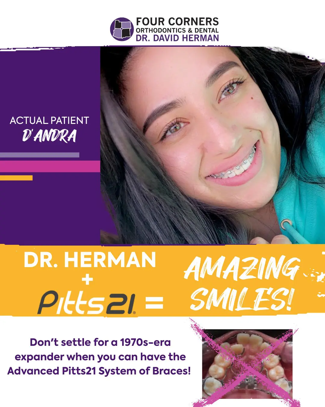 Bright orthodontic ad featuring a smiling patient with braces. Text highlights Dr. Herman's use of the Pitts21 system for "Amazing Smiles."
