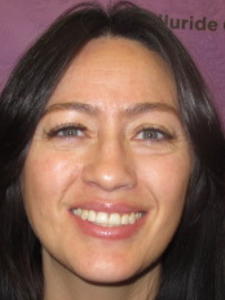 Adelle A After-Retreatment