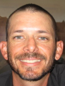 Casey Cline Before-Normal Bite