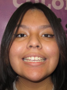 Kamali After Face-Crowding