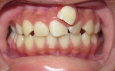 Kamali Before-Crowding