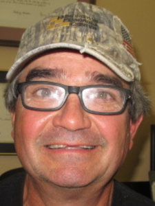 Mike Culver Before- Combo Dental