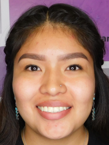 Shaydreanna After-Wide Smile