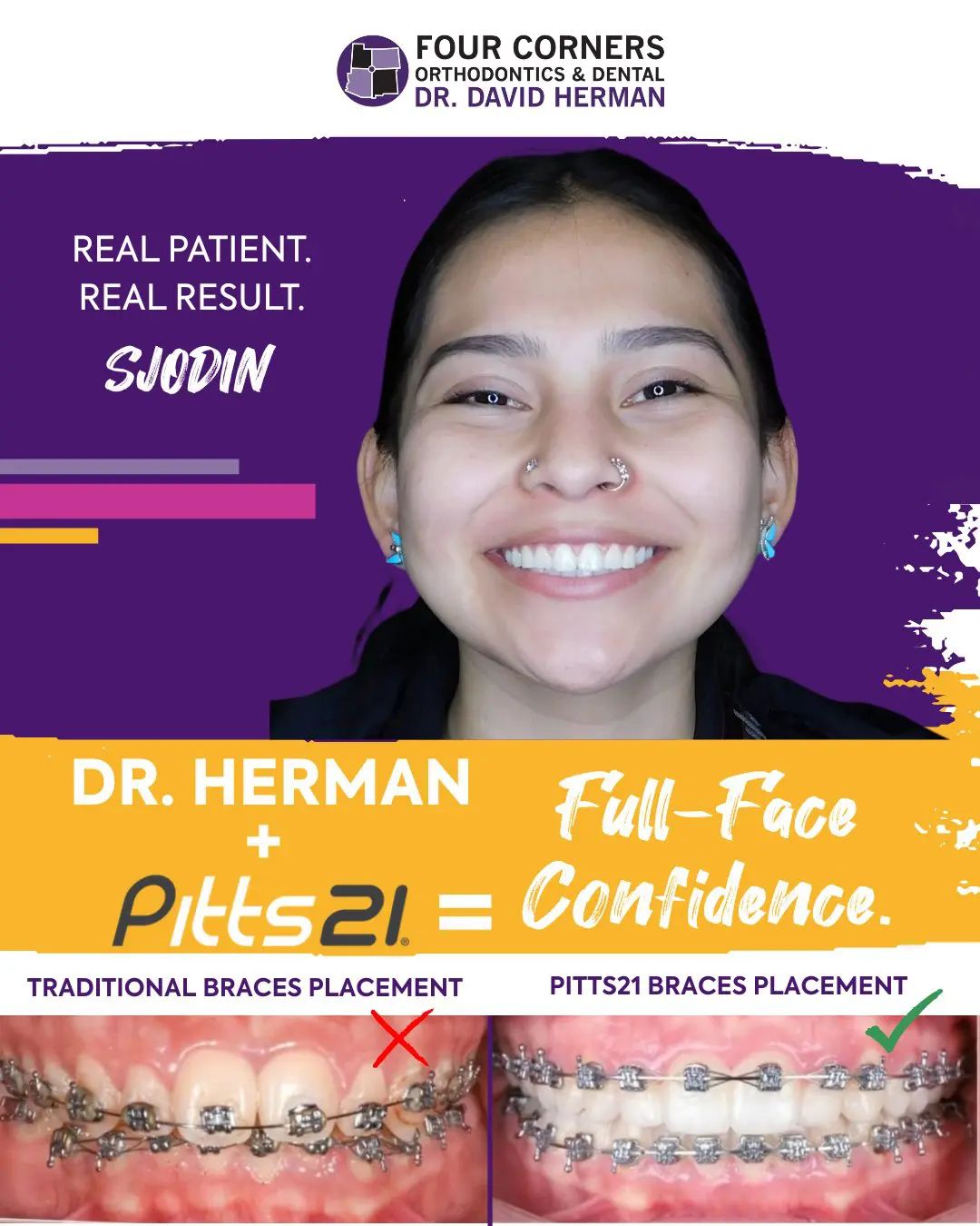 A smiling woman, representing a real patient, promotes Four Corners Orthodontics. Below, a comparison shows traditional braces versus Pitts21 braces, highlighting improved alignment.