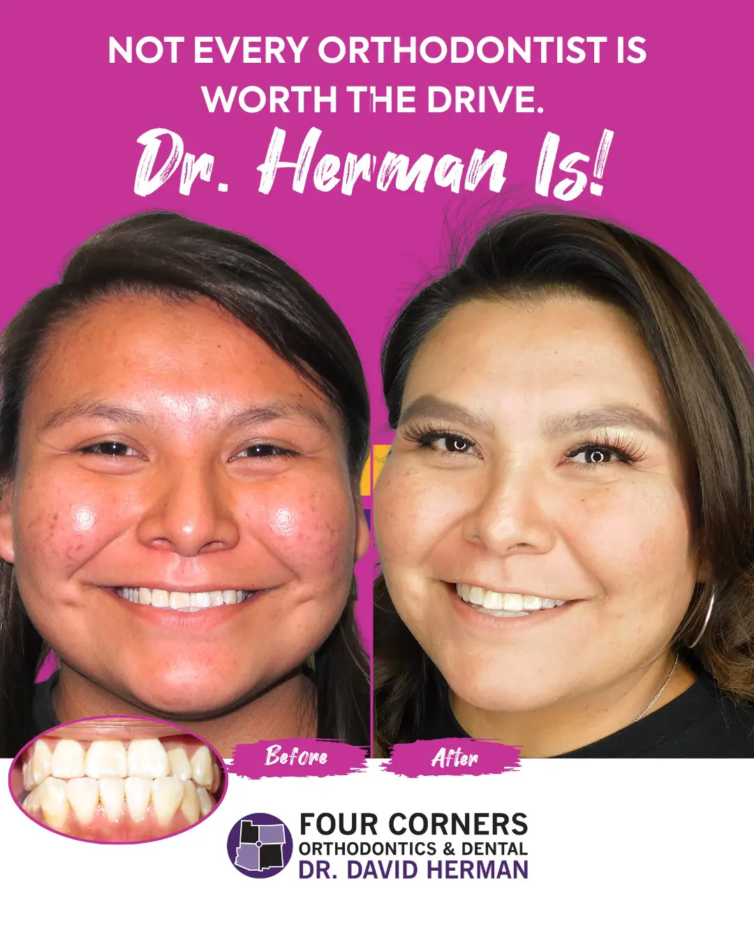 Smiling before-and-after orthodontic photos show improved teeth alignment. Text reads, "Not Every Orthodontist Is Worth The Drive. Dr. Herman Is!"