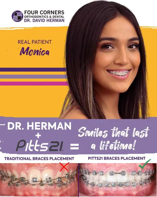 Smiling woman with braces, promoting Four Corners Orthodontics. Text highlights "Pitts21" system benefits with comparison images of traditional and Pitts21 braces.