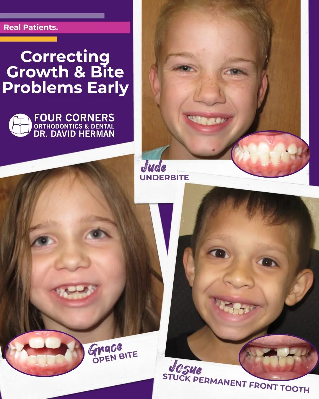 Portraits of three children smiling at a dentist's office. Each has a dental issue highlighted with a close-up: underbite, open bite, and a stuck permanent front tooth. The text reads, "Correcting Growth & Bite Problems Early" with the clinic's logo and name.